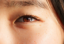 Cara Agar Mata Tidak Sipit