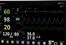 Cara Baca Monitor ICU