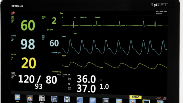 Cara Baca Monitor ICU