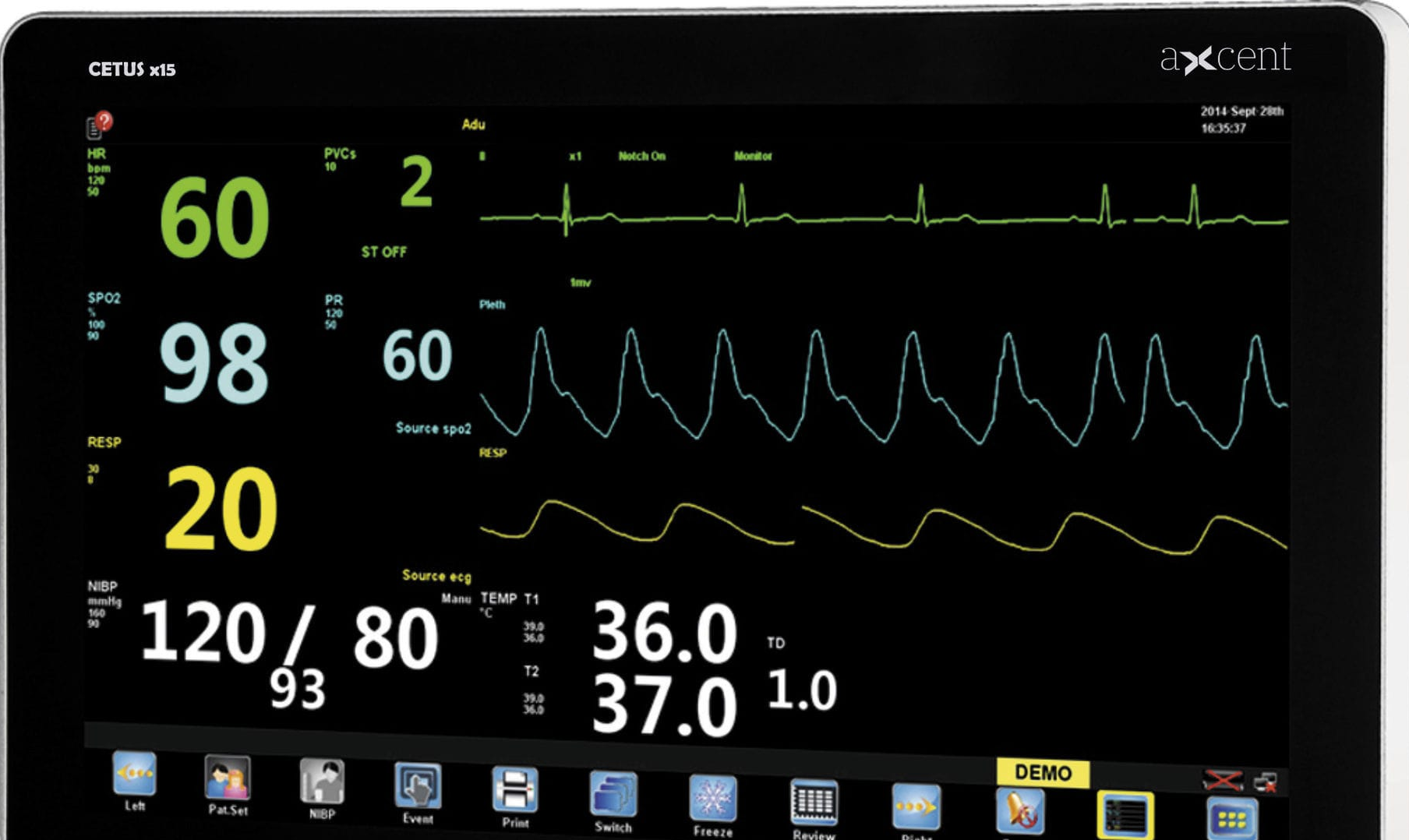 Cara Baca Monitor ICU